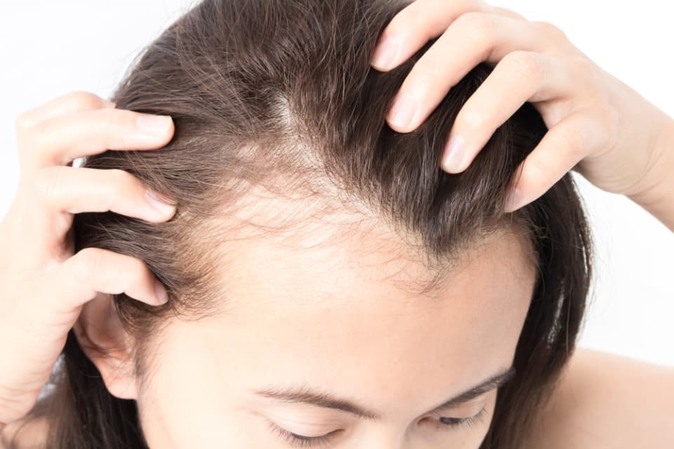 Smile Hair Clinic Guide to Hair transplant Turkey Excellence